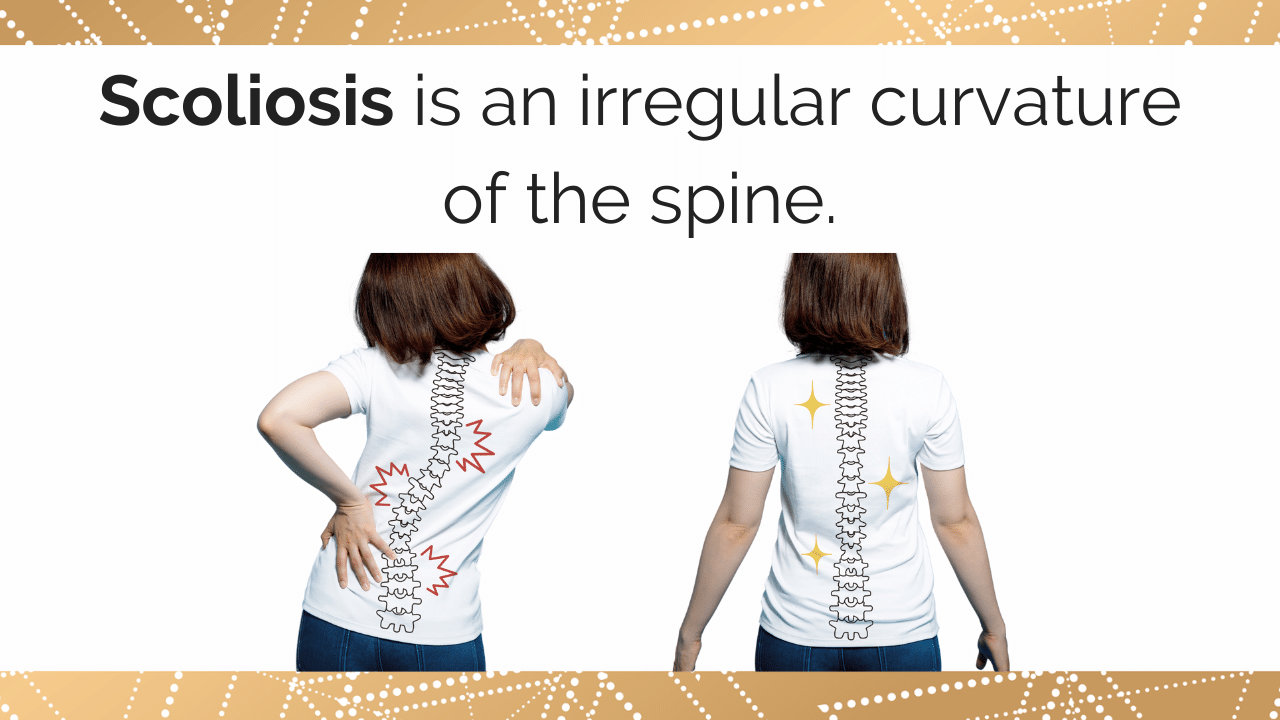 scoliosis