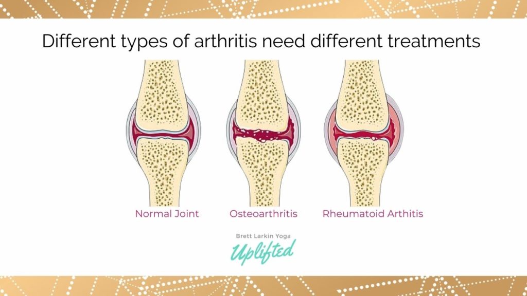 different types of arthritis